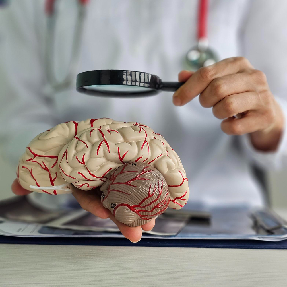 Reabilitare neurologică